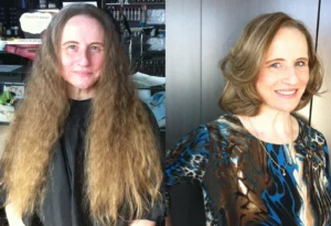 before after 1
