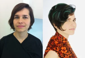 before after 2
